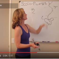 Scoliosis-pilates-barcelona 2